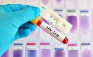 HIV