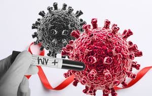 HIV
